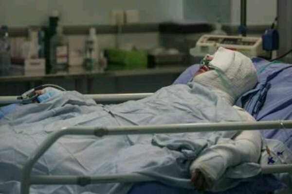 ۸۵ درصد سوختگی‌ها با روش‌های ساده قابل پیشگیری است